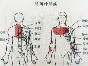 最新针灸疗法，探索传统智慧与现代科技的完美融合